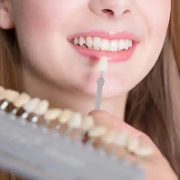 Porcelain Veneers Image