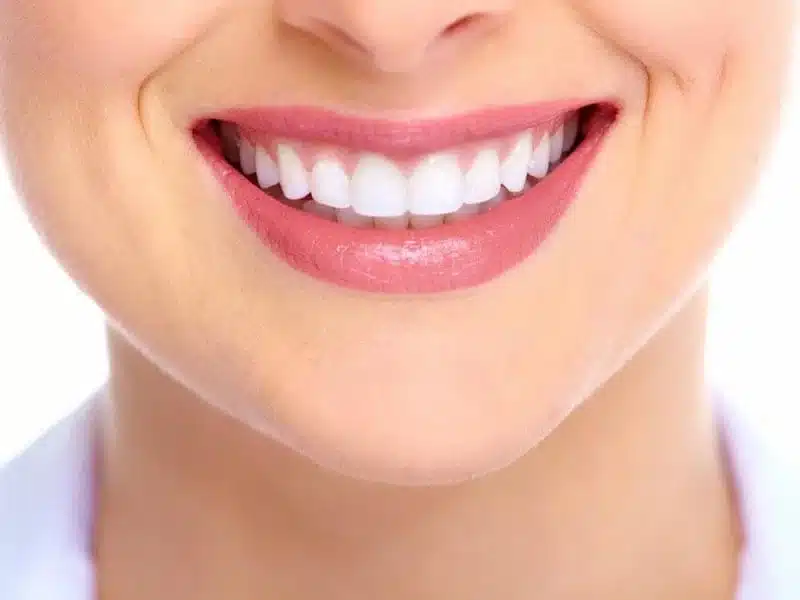 Cosmetic bonding img