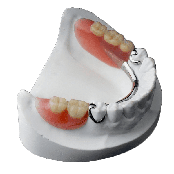 partial dentures